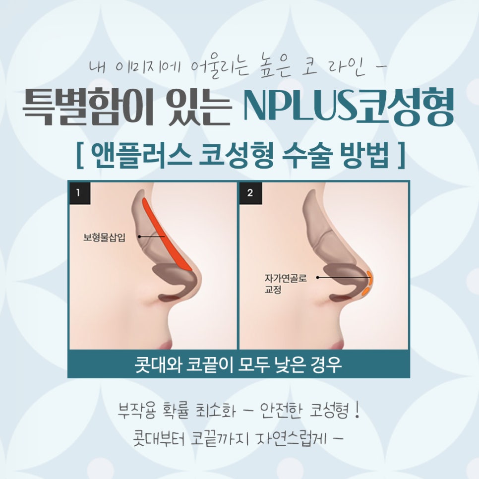 코성형잘하는병원 자연스러운 라인으로 관련 이미지 8
