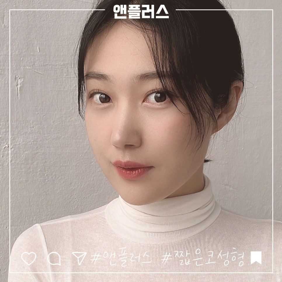 Naturally and Beautifully Through Short Nose Surgery image 13