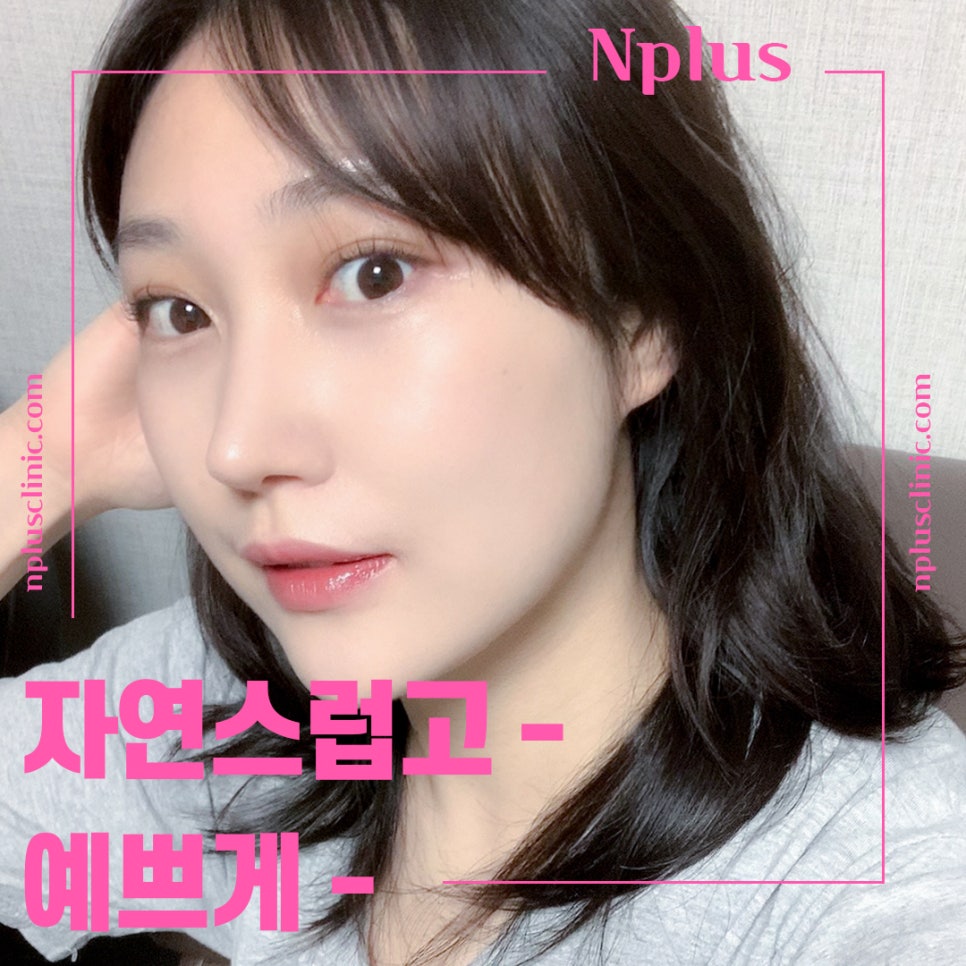 A Refined Look Through Female Hump Nose Surgery image 3