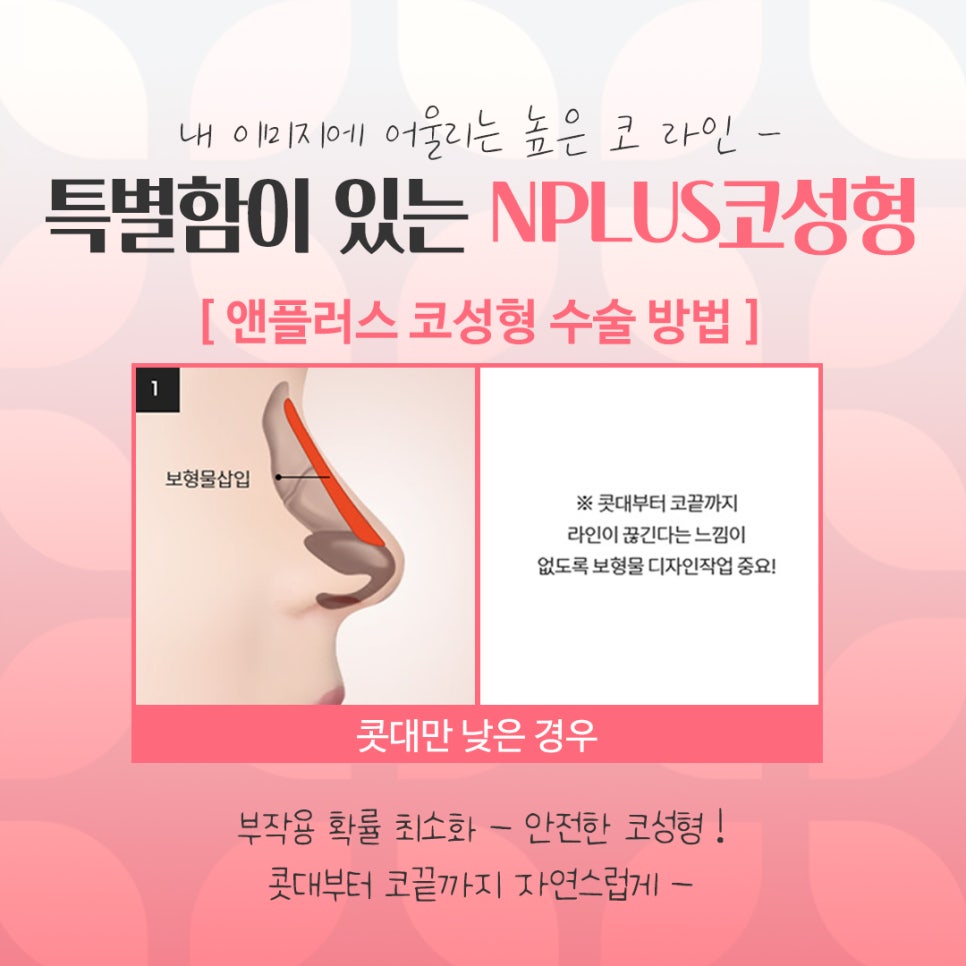 If You’re Looking for Detailed Reviews of Female Rhinoplasty image 9