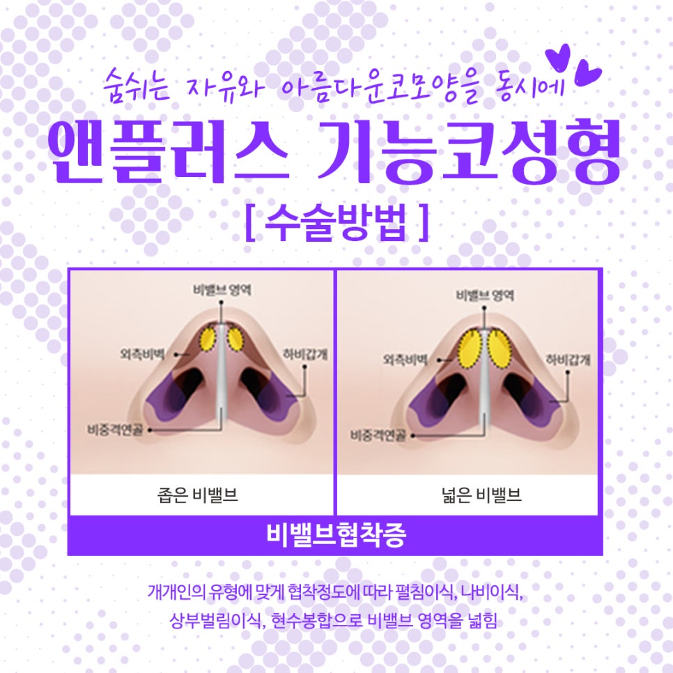 Nose Surgery Review from Anplus Plastic Surgery image 10