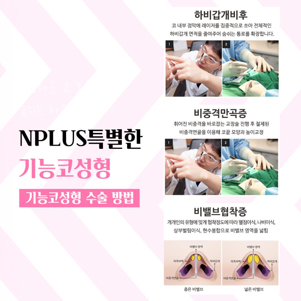 앤플러스 기능코수술후기 선택의 중요성 관련 이미지 9