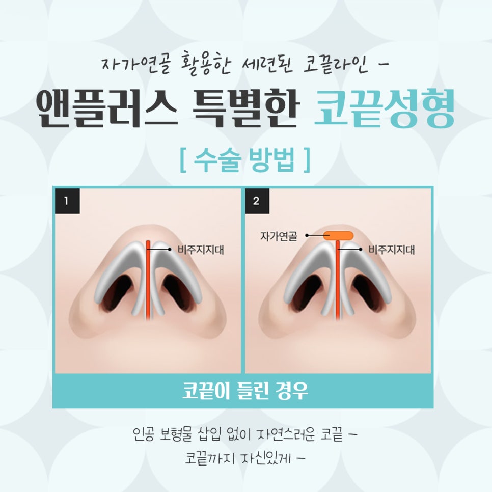 Looking Into Tip Rhinoplasty Reviews and a Natural-Looking Image image 8