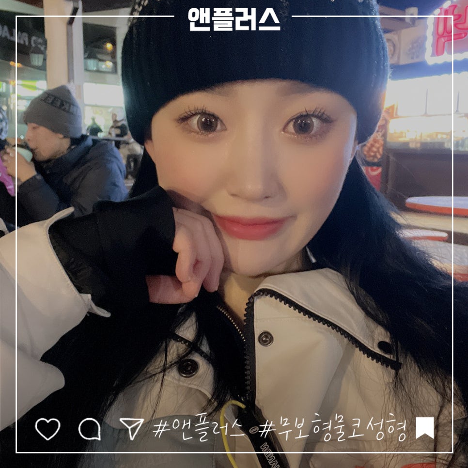 Review of Non-Implant Nose Surgery for a Beautiful Line image 2