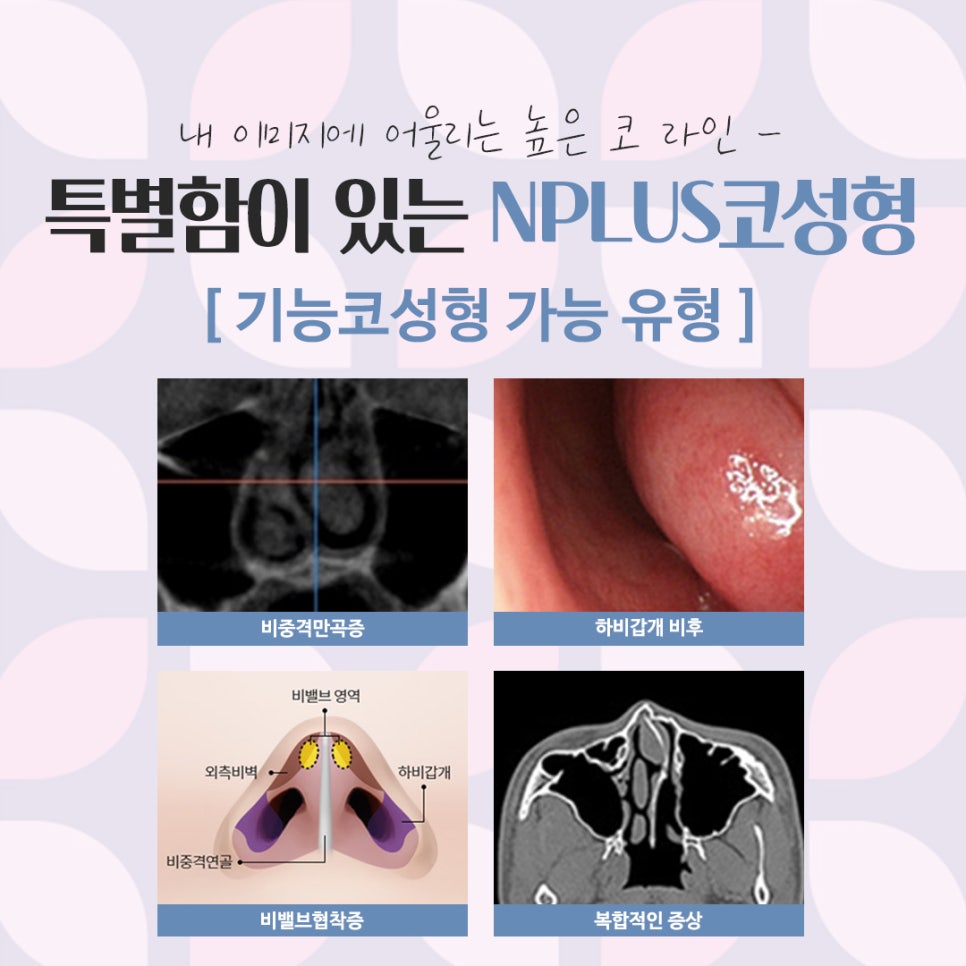 Nose Surgery Review: A Natural and Glamorous Line image 4