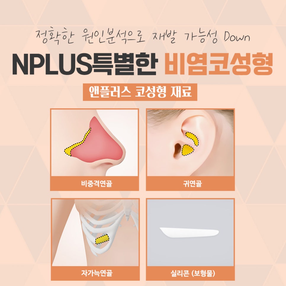 A Satisfying Result with One Rhinoplasty and Rhinitis Surgery image 10