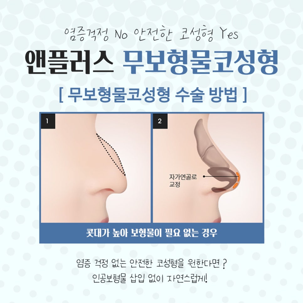 무보형물코수술을 통해 자연스러운 코라인으로 관련 이미지 7