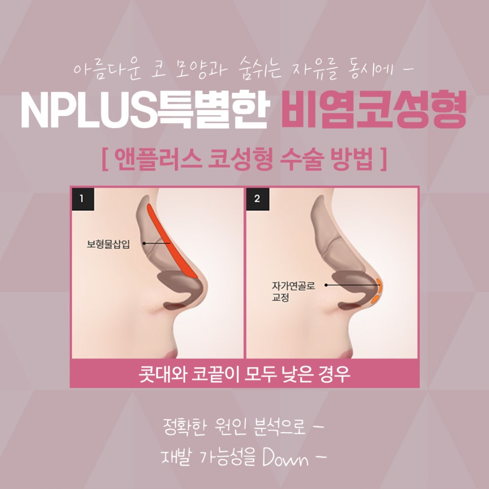 Nasal Surgery Review: Make Sure You Understand It Clearly image 11