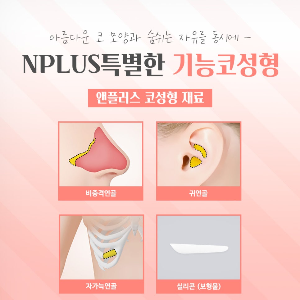 기능코성형전후를 찾아보고 관련 이미지 11