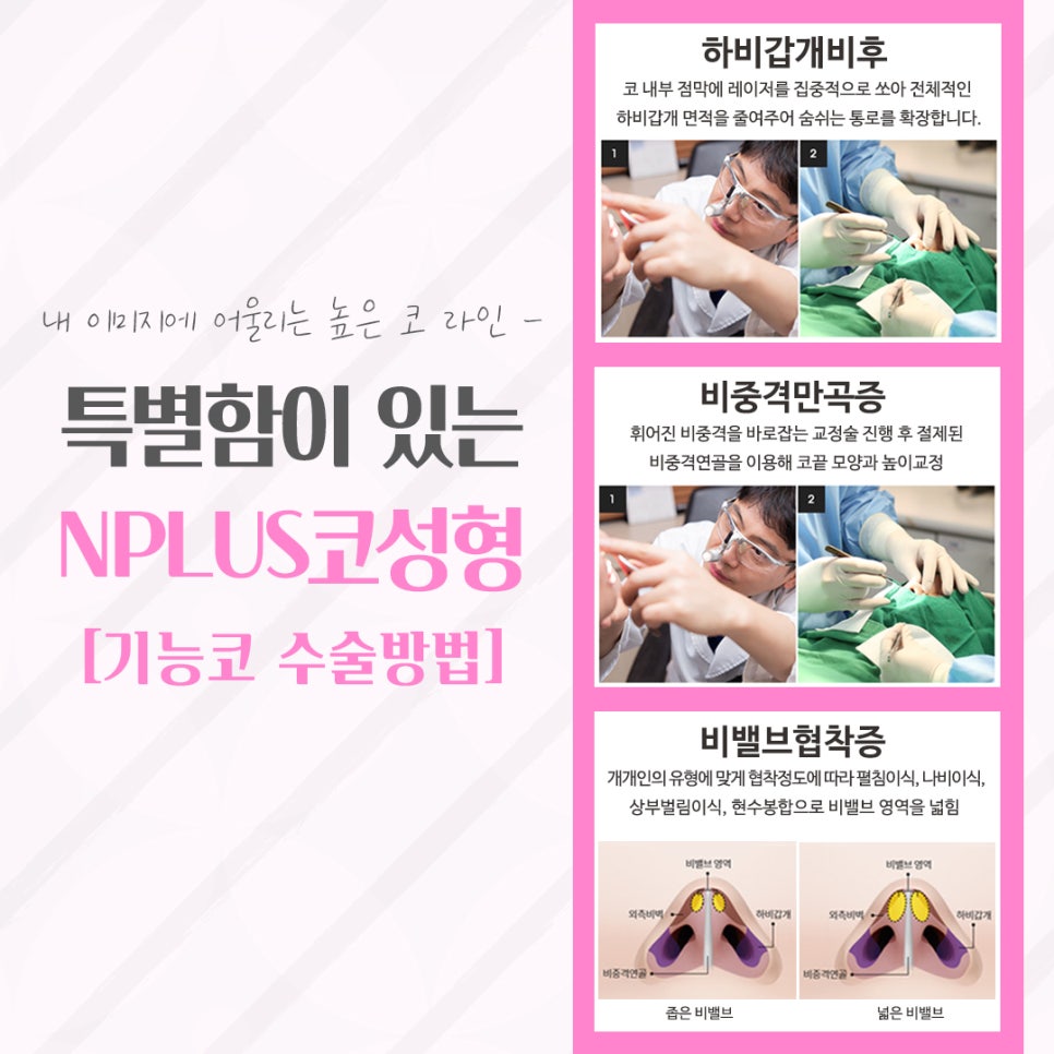 압구정코수술 자연스러운 라인으로 관련 이미지 10