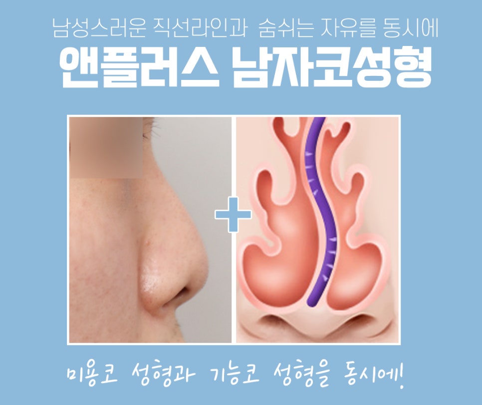 남자코성형후기 기능까지 추가하여 관련 이미지 5