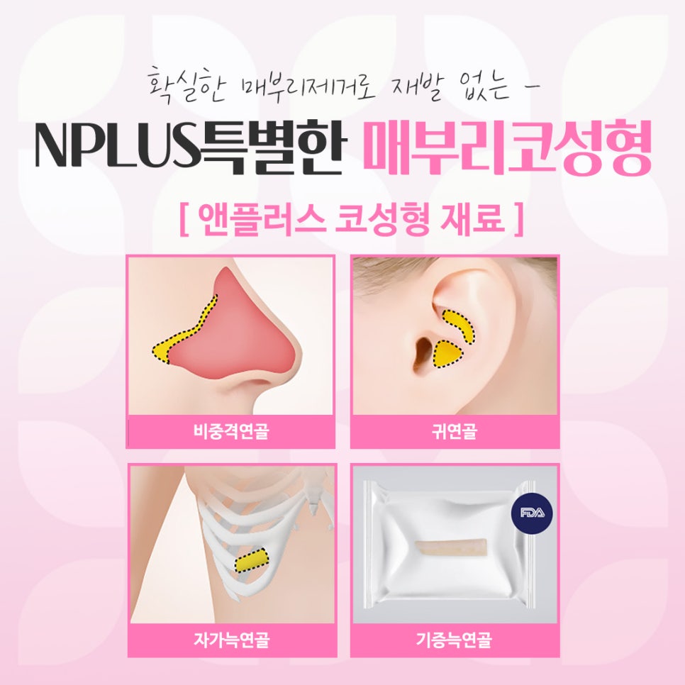 매부리코수술전후 비교를 한다면 관련 이미지 11