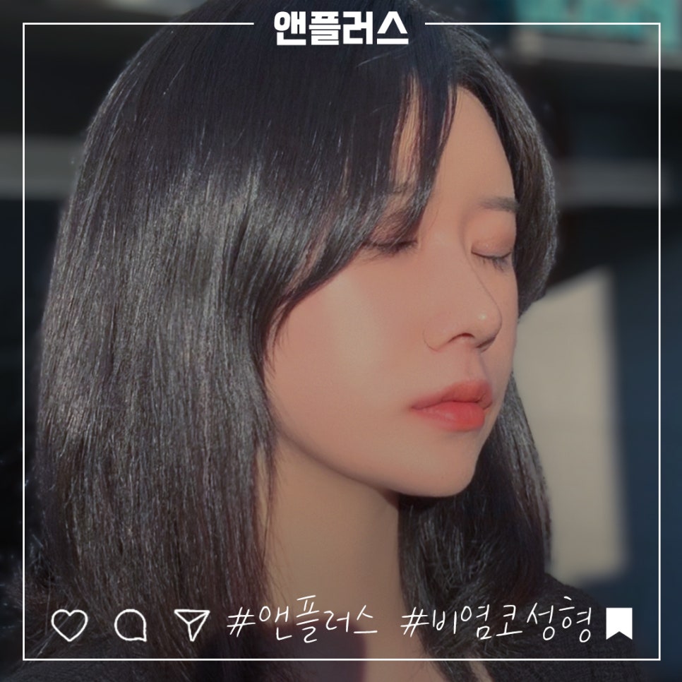 Review of Rhinoplasty for Rhinitis: Check and Decide image 1
