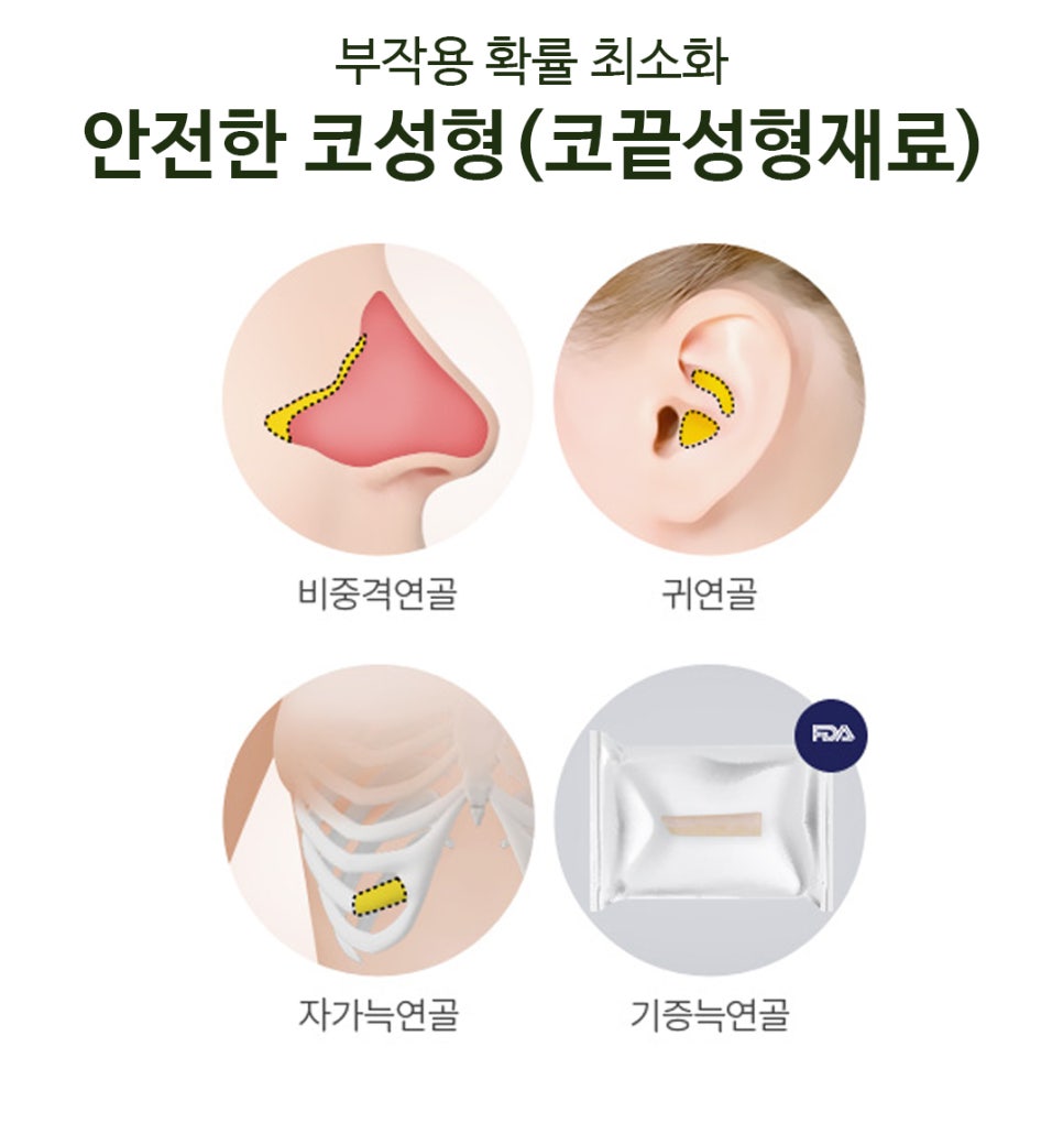 Apgujeong Nose Surgery, Beautiful and Natural image 4