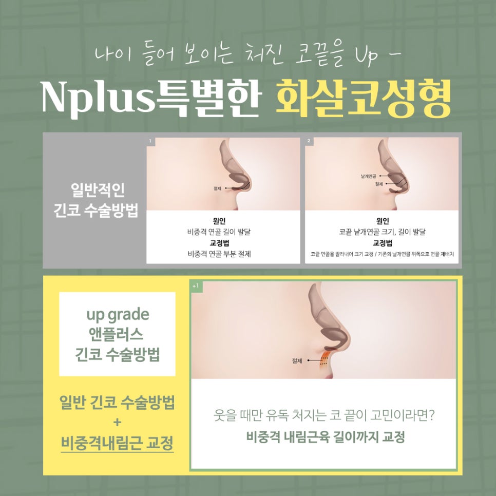 화살코성형 후기까지 확실하게 관련 이미지 12