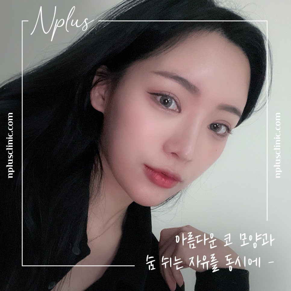 자가늑연골코수술 기능까지 생각해서 관련 이미지 3