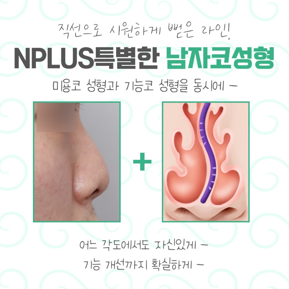 남자코성형 전체적인 라인을 고려하여 관련 이미지 4