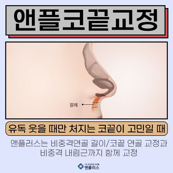 화살코성형 코끝이 고민일때 관련 이미지 2
