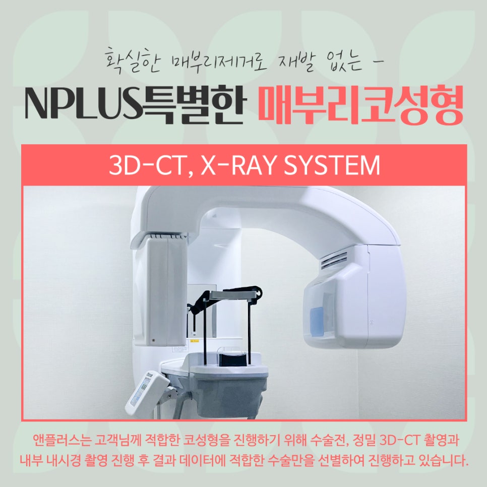 매부리코교정으로 부드러운 인상 관련 이미지 7