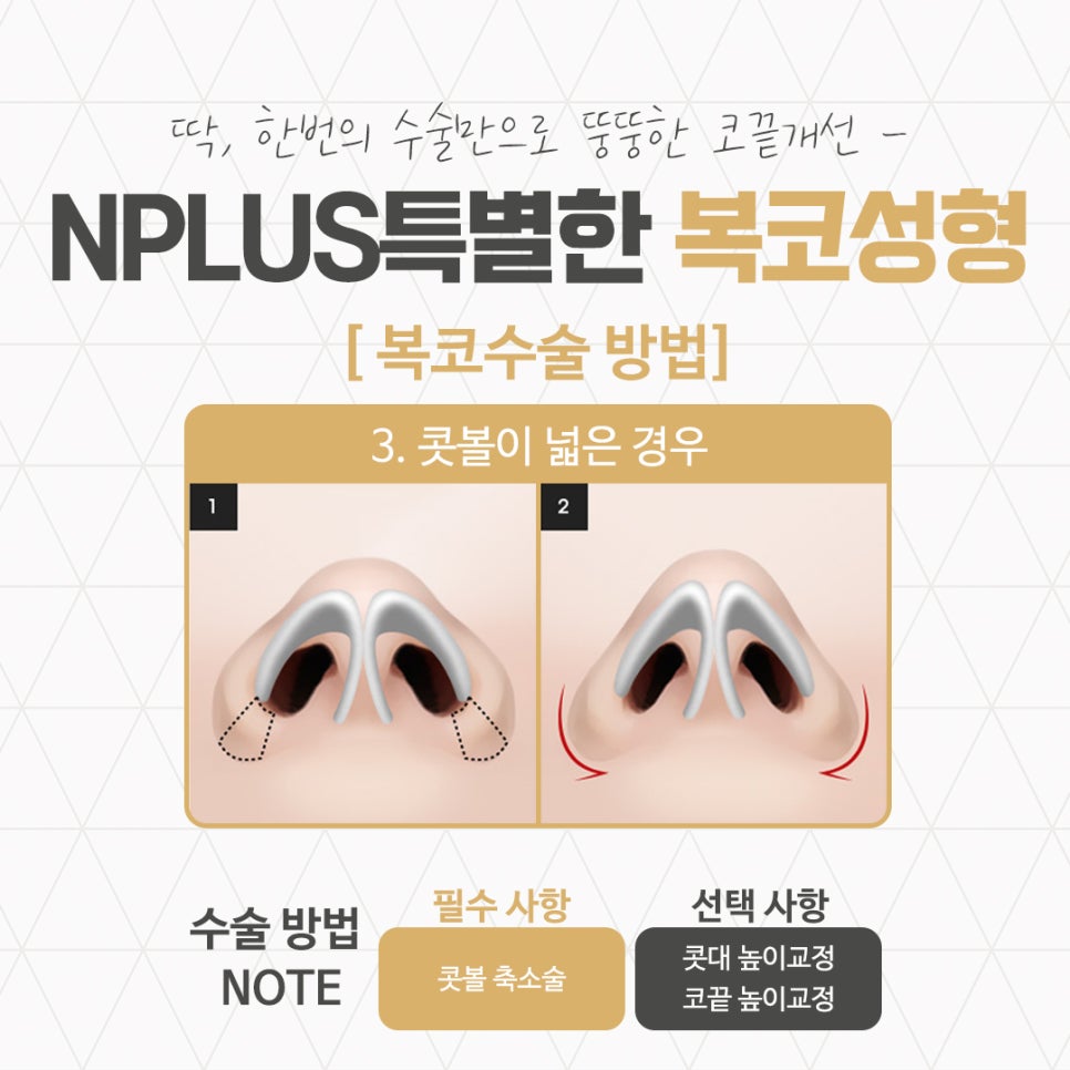 Taking a Thorough Look at Bulbous Nose Surgery Reviews image 9