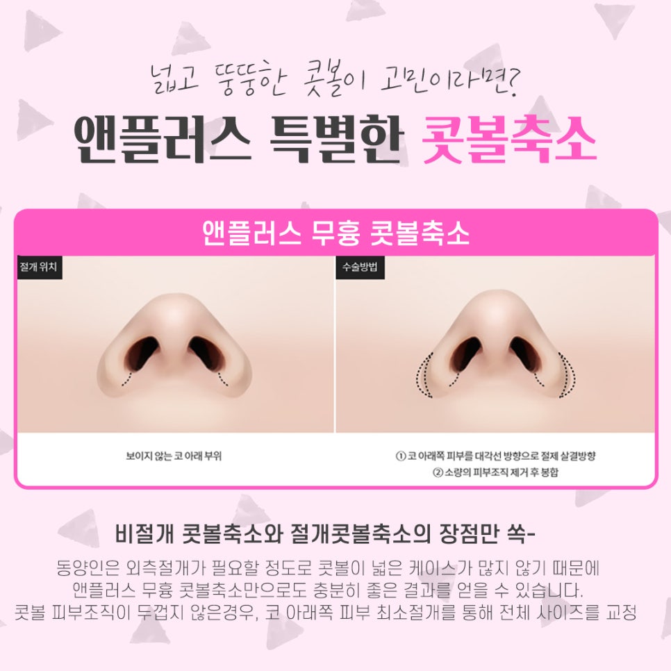 If You Want to Learn About Nostril Reduction Reviews image 5