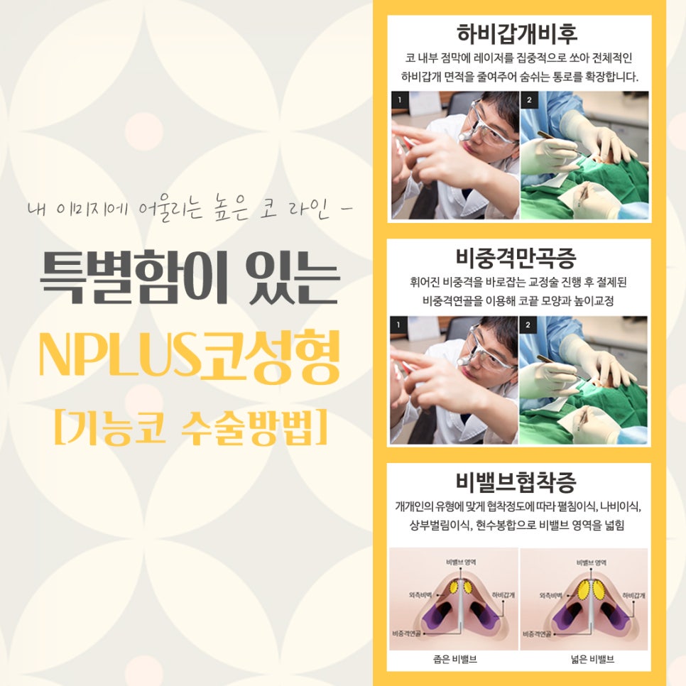 코성형잘하는병원에 대해 알아보고 관련 이미지 10
