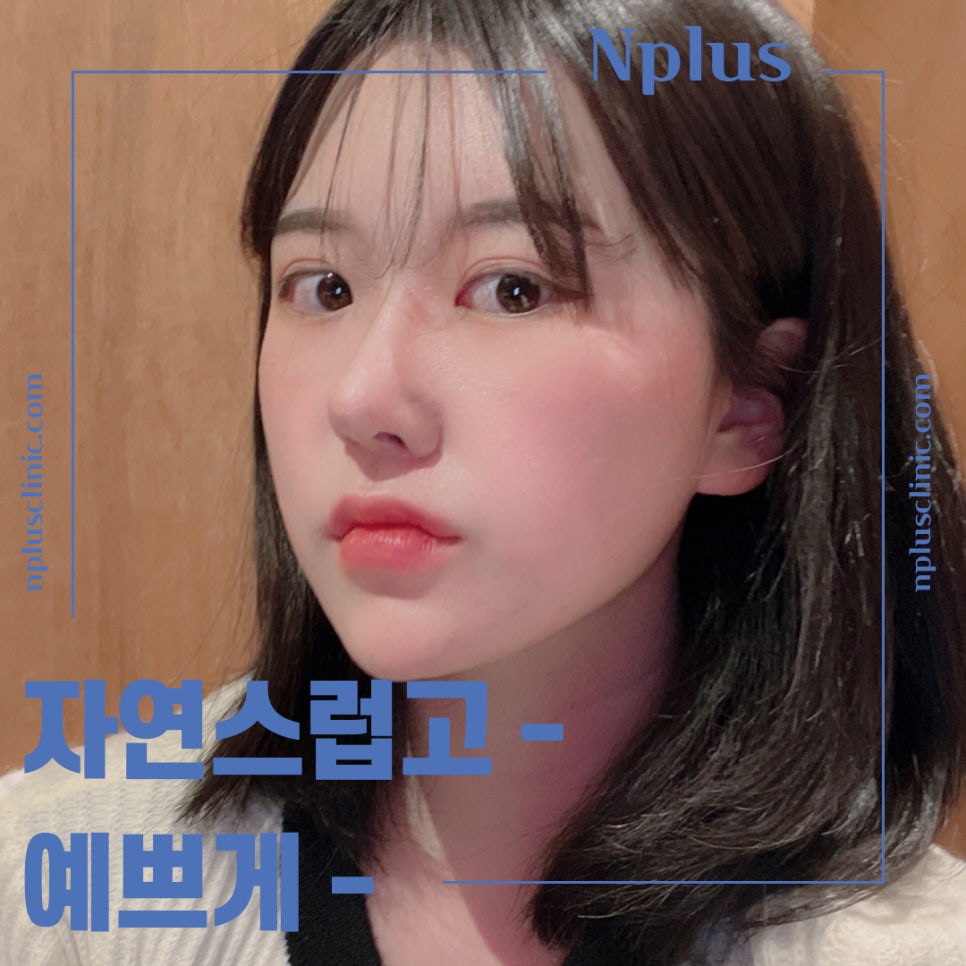 Broad Nose Surgery Review for a Refined Look image 6