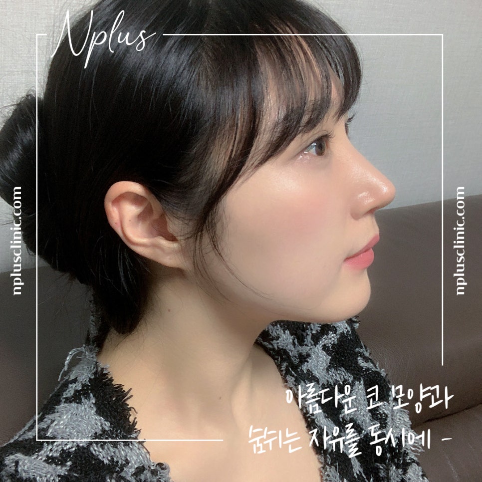 The Importance of Choosing Coverage for Nose Surgery image 11