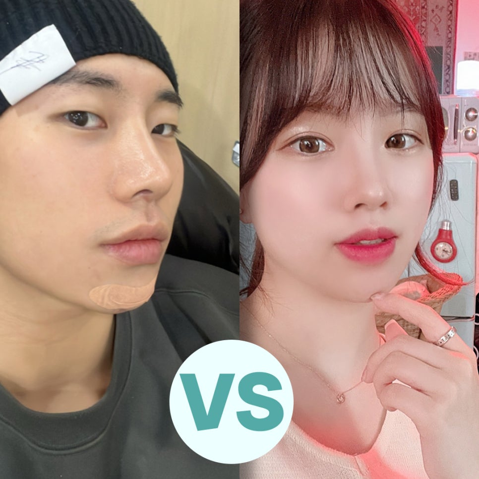 남자코성형후기 기능에 대해 알아보고 관련 이미지 9