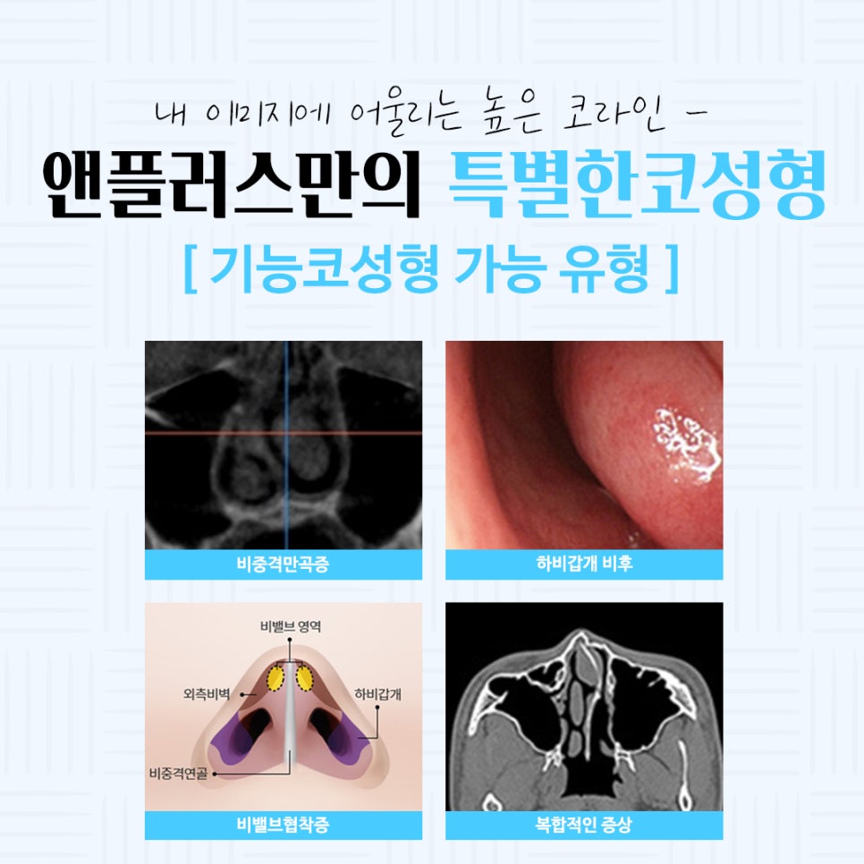 Learn About Autologous Cartilage Rhinoplasty image 10