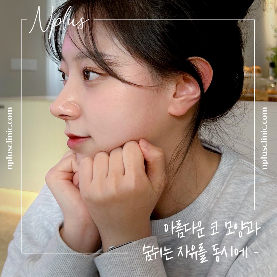 코수술후기를 통해 내게 어울리는 라인으로 관련 이미지 2