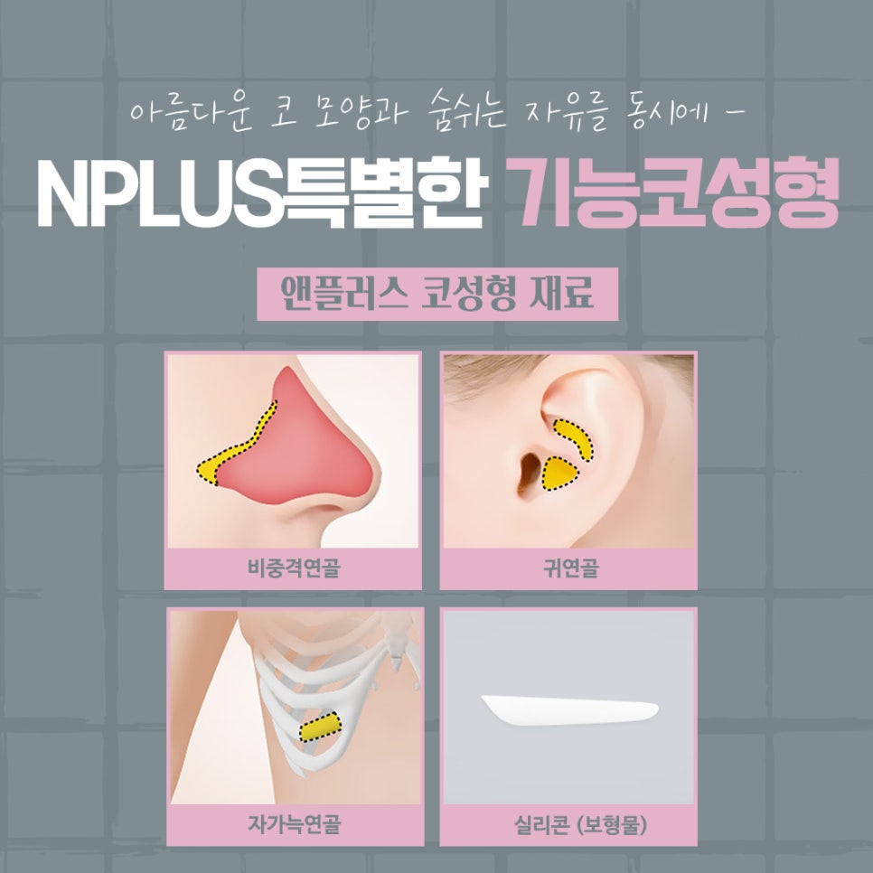 코성형후기 자연스럽고 예쁘게 관련 이미지 11