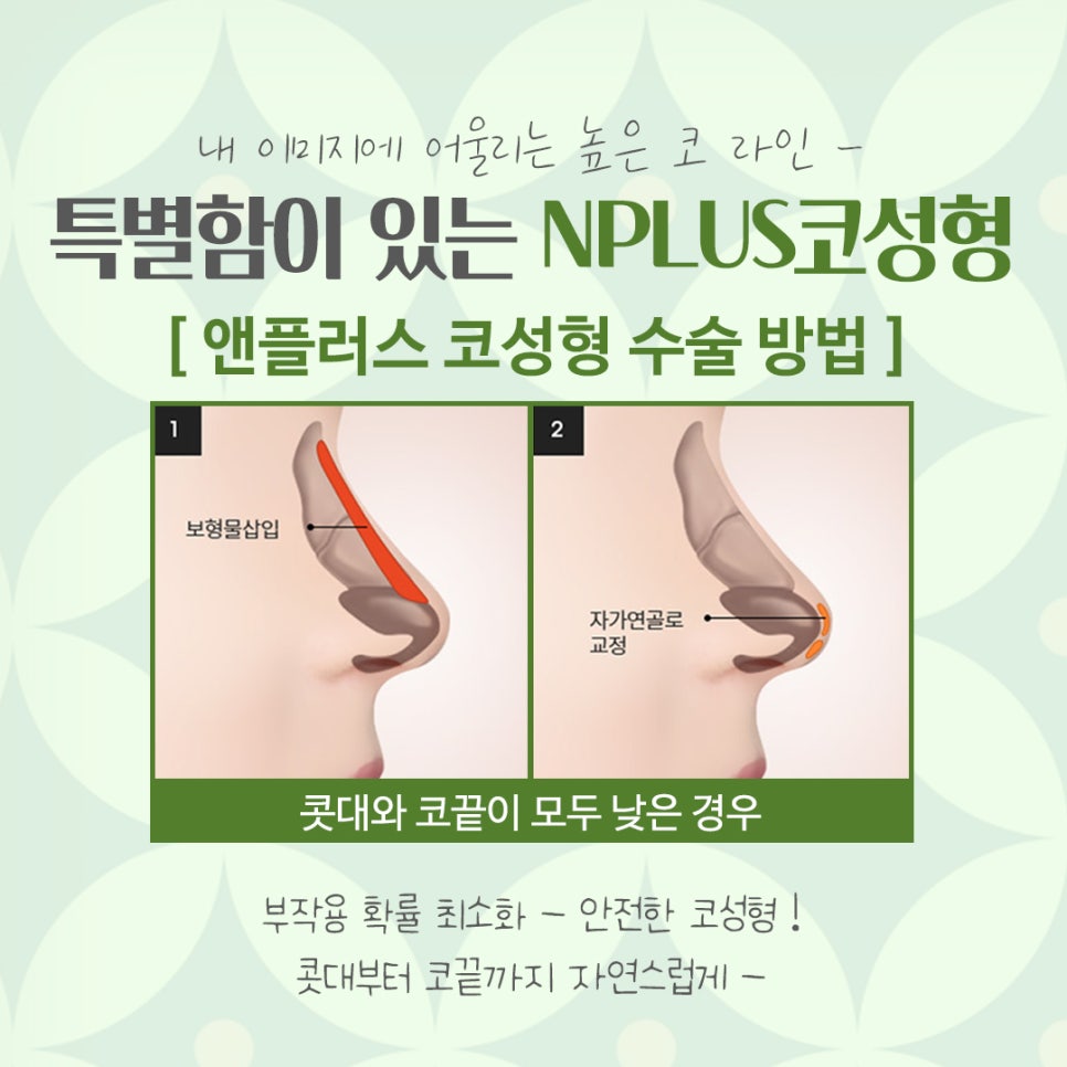 코수술잘하는병원을 찾아보고 관련 이미지 8
