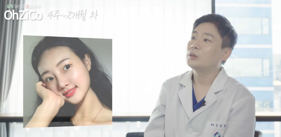 짧은코수술 후기까지 자세하게 알아보고 관련 이미지 25