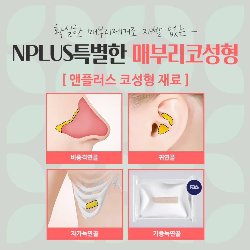 매부리코교정으로 부드러운 인상 관련 이미지 12