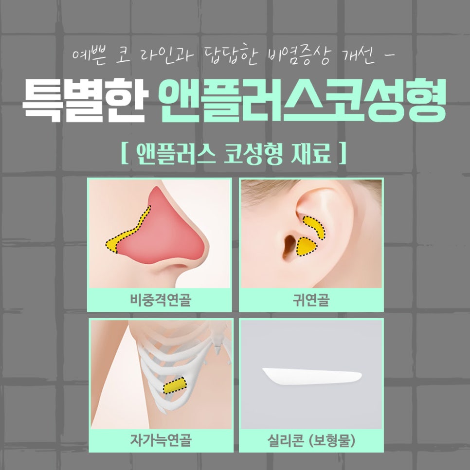강남코수술후기 확실하게 알아보고 관련 이미지 9