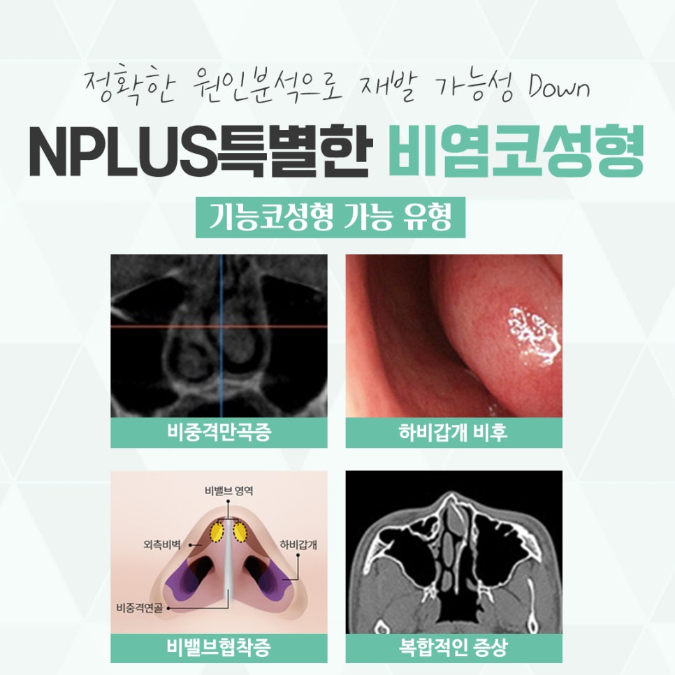 Check Nasal Surgery and Rhinoplasty in Detail image 6