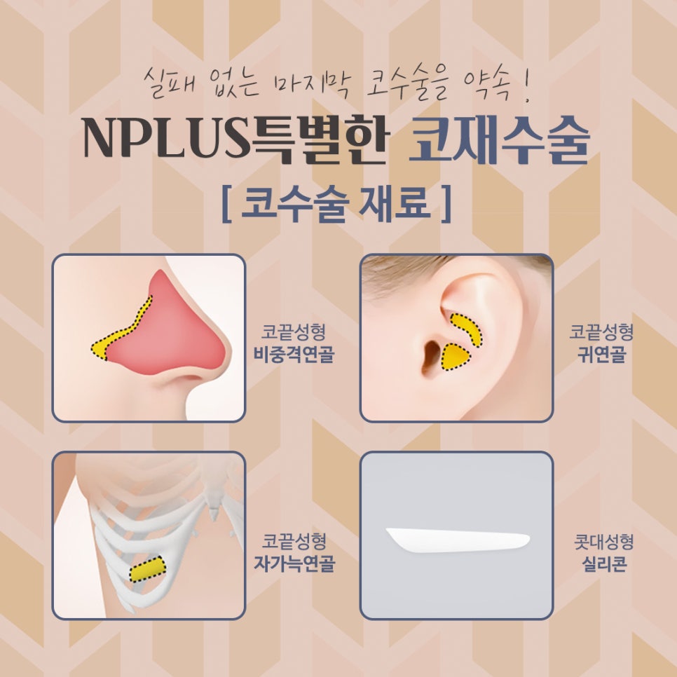 자가늑연골 활용한 코재수술후기 관련 이미지 8