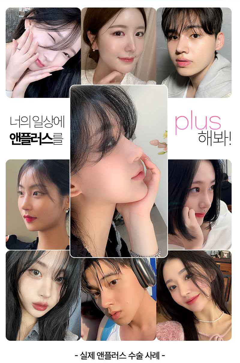앤플러스 자가늑코성형은 예쁘다! 관련 이미지 8