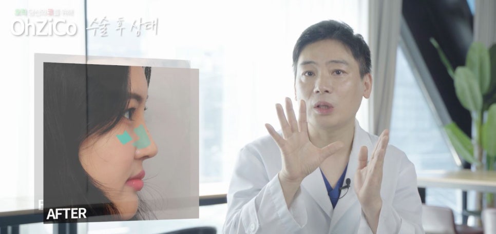 짧은코수술 후기까지 자세하게 알아보고 관련 이미지 6