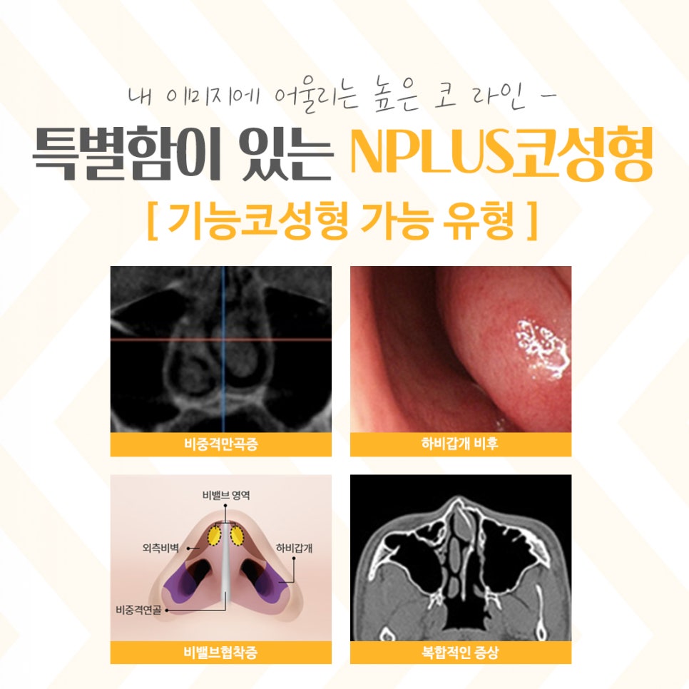 코성형잘하는곳에서 세련된 라인으로 관련 이미지 6