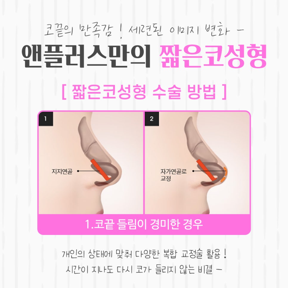 짧은코성형을 통해 세련된 이미지로 관련 이미지 8
