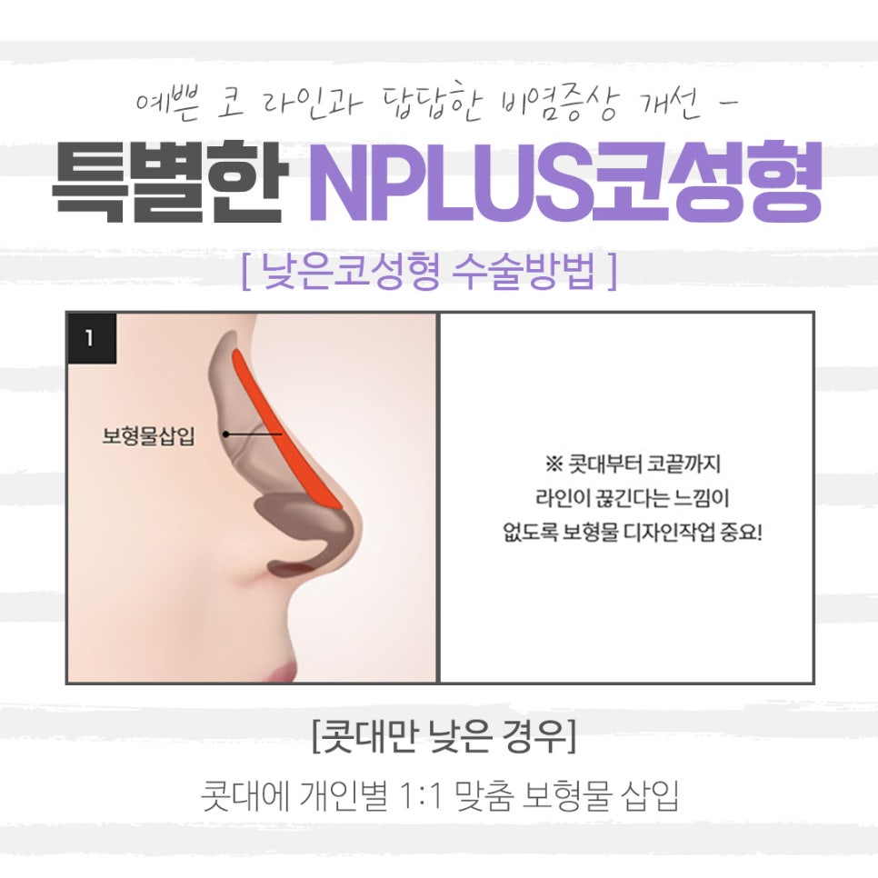 Checking Whether Low Nose Surgery Reviews Are Safe image 9