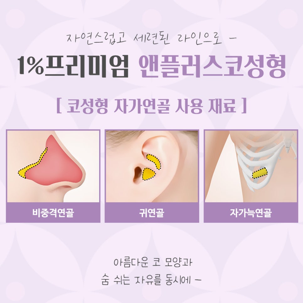 늑연골 코수술 자세하게 알아보고 관련 이미지 5