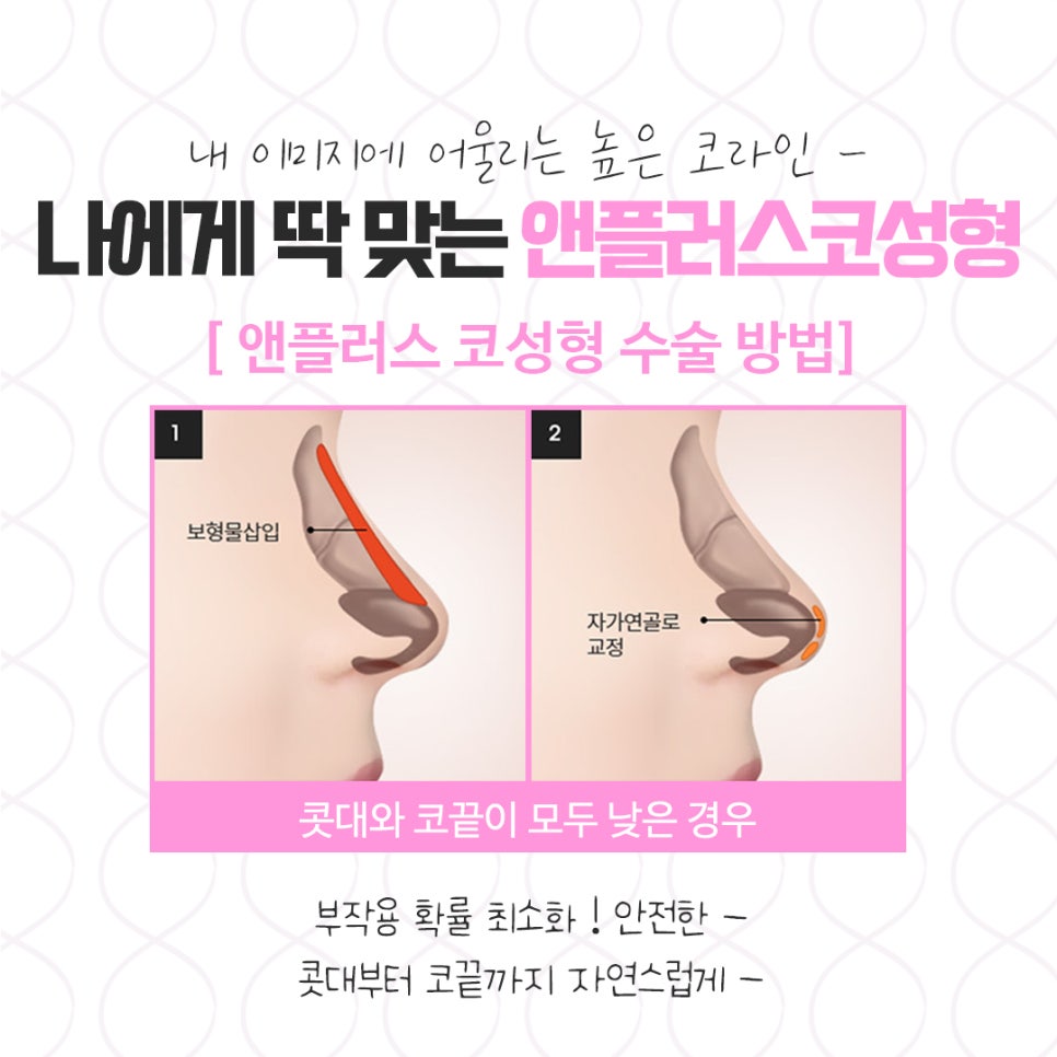 코뼈골절 정확한 진단으로 관련 이미지 6