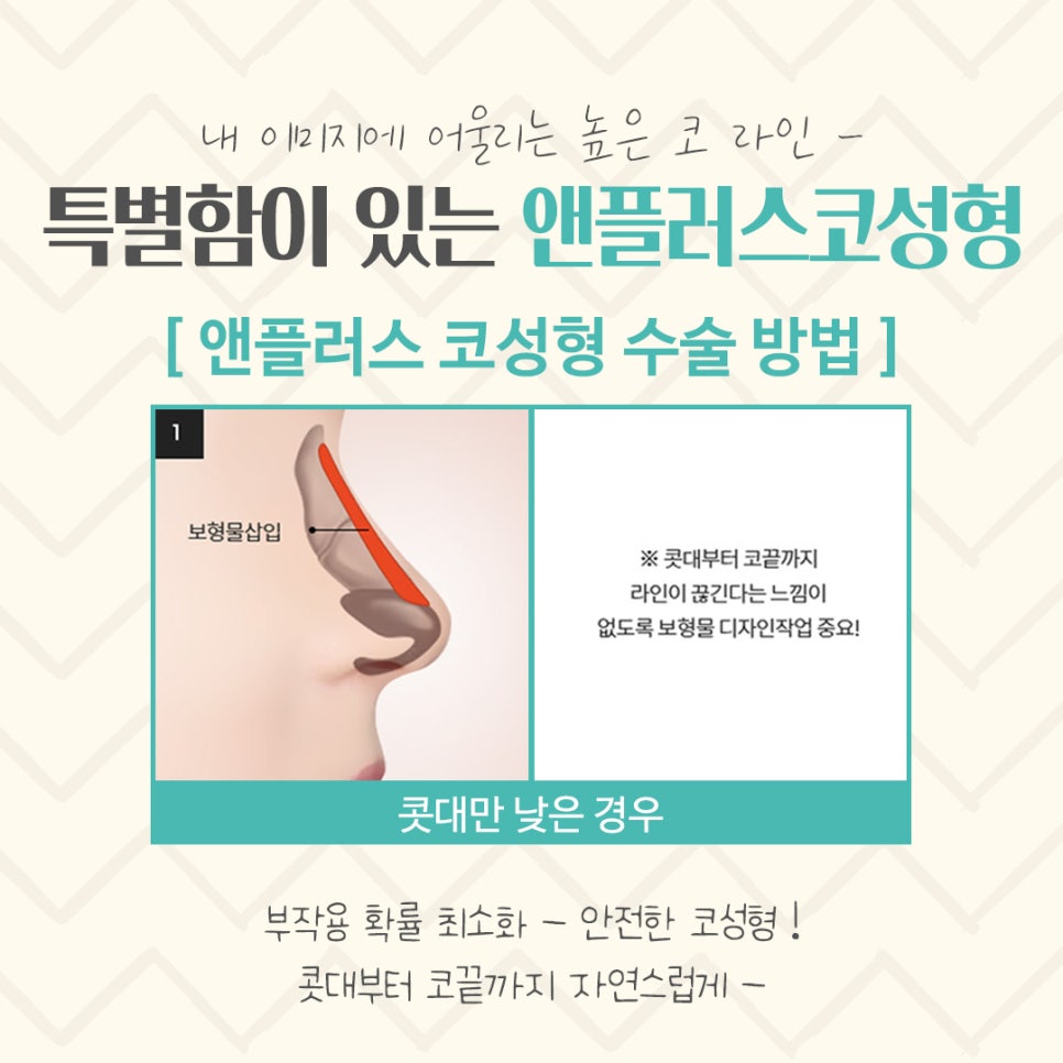 코수술후기 자세하게 알아보고 판단 관련 이미지 8