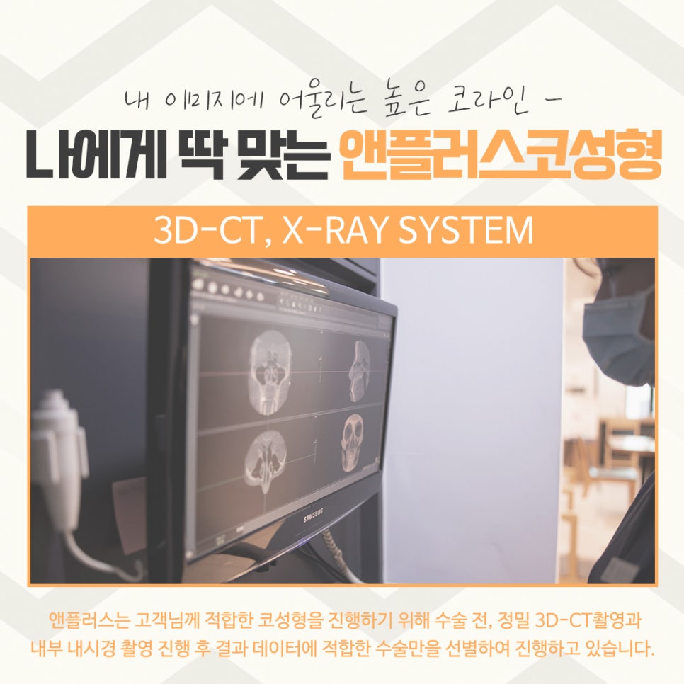 코수술후기에 대해 자세하게 알아보고 관련 이미지 7