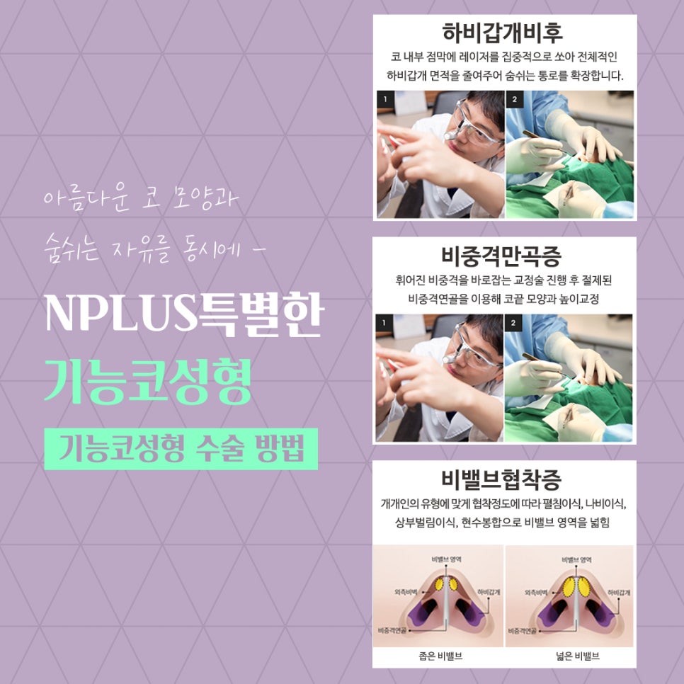 앤플러스의원에서 알려드리는 기능코성형 관련 이미지 10