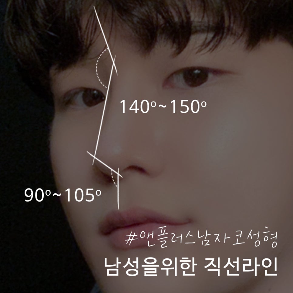 A Sophisticated Image Transformation Before and After Male Nose Surgery image 8