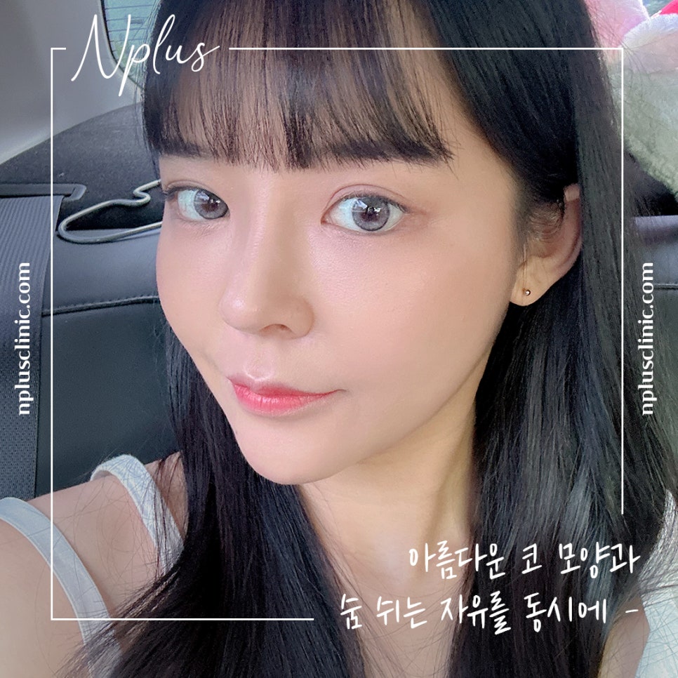 늑연골코성형을 고민한다면 관련 이미지 1